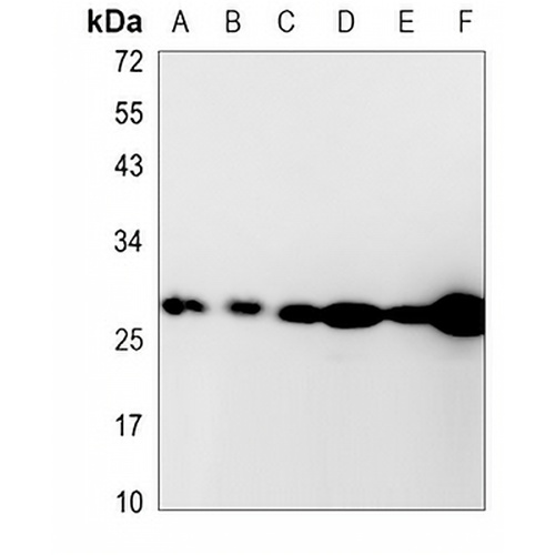 AK2 Rabbit Monoclonal Antibody(C824)