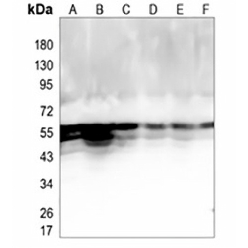 NAP1L1 Rabbit Monoclonal Antibody(C825)