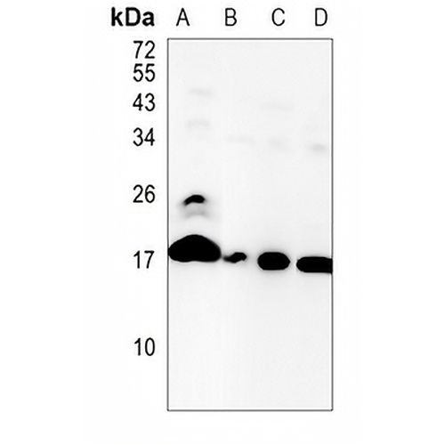 Destrin Rabbit Monoclonal Antibody(C826)