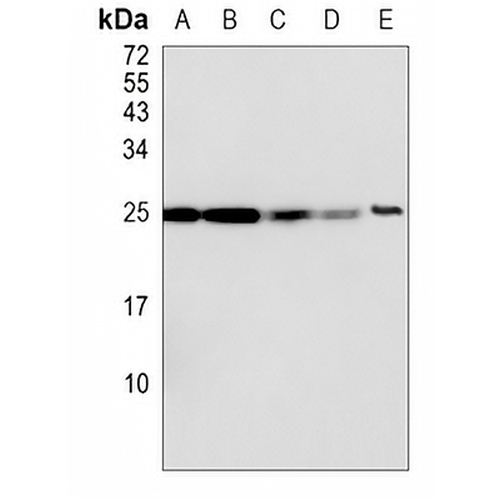 RPL10A Rabbit Monoclonal Antibody(C829)