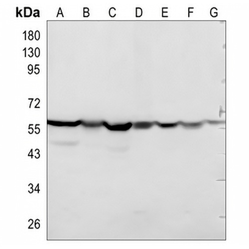 CCT2 Rabbit Monoclonal Antibody(C830)