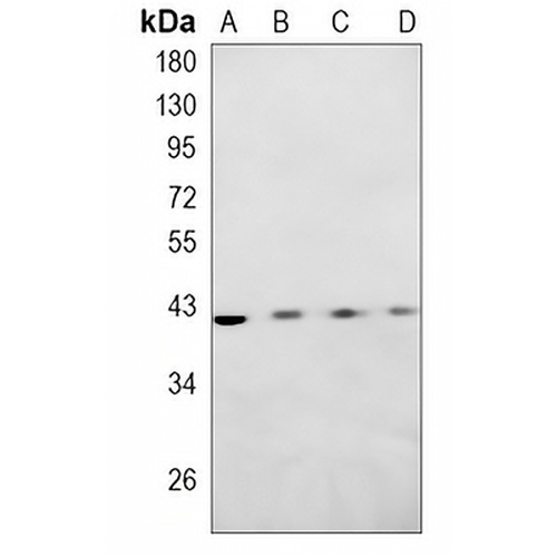 ESE-1 Rabbit Monoclonal Antibody(C831)