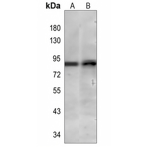 TLE1 Rabbit Monoclonal Antibody(C833)
