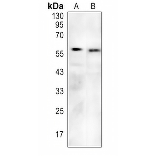 ACVR1 Rabbit Monoclonal Antibody(C834)