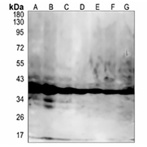 Cyclophilin D Rabbit Monoclonal Antibody(C836)