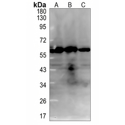 MAdCAM-1 Rabbit Monoclonal Antibody(C838)