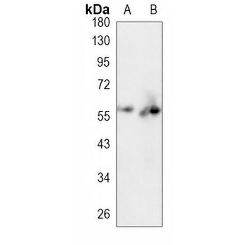 IRF3 Rabbit Monoclonal Antibody(C839)