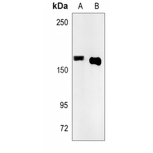 SMC1A Rabbit Monoclonal Antibody(C840)