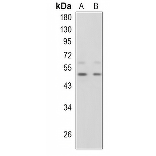 SHH Rabbit Monoclonal Antibody(C842)