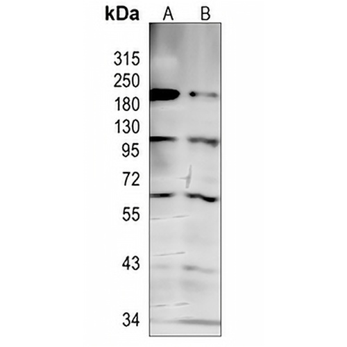 EZH2 Rabbit Monoclonal Antibody(C843)