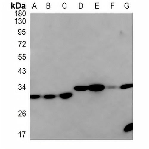 IGFBP7 Rabbit Monoclonal Antibody(C844)