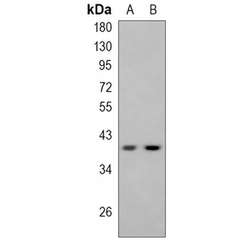 p38 Rabbit Monoclonal Antibody(C845)
