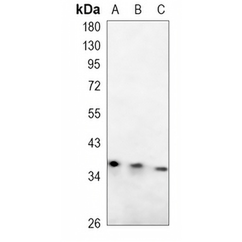 SMN Rabbit Monoclonal Antibody(C847)