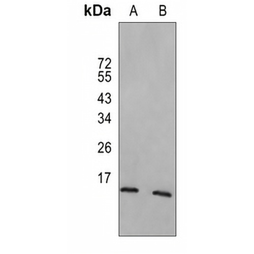 SUMO4 Rabbit Monoclonal Antibody(C848)