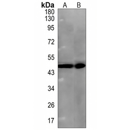Rab 9 p40 Rabbit Monoclonal Antibody(C849)