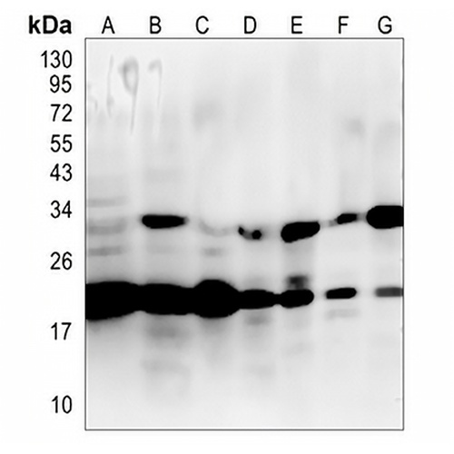 AKAP14 Rabbit Monoclonal Antibody(C850)