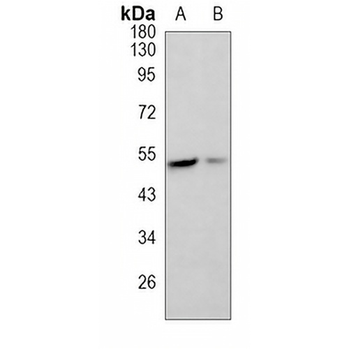 MLKL Rabbit Monoclonal Antibody(C851)