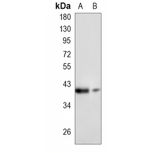 FBXO32 Rabbit Monoclonal Antibody(C854)