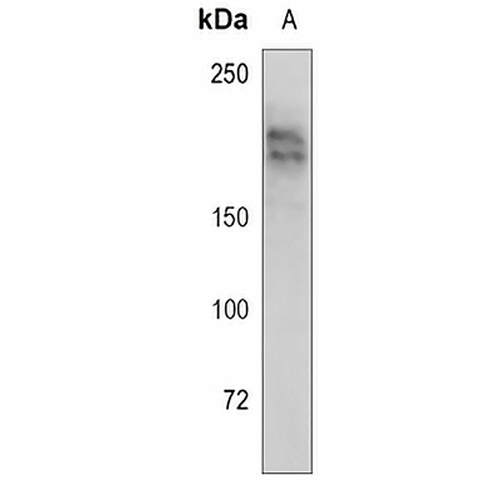 G9A Rabbit Monoclonal Antibody(C855)