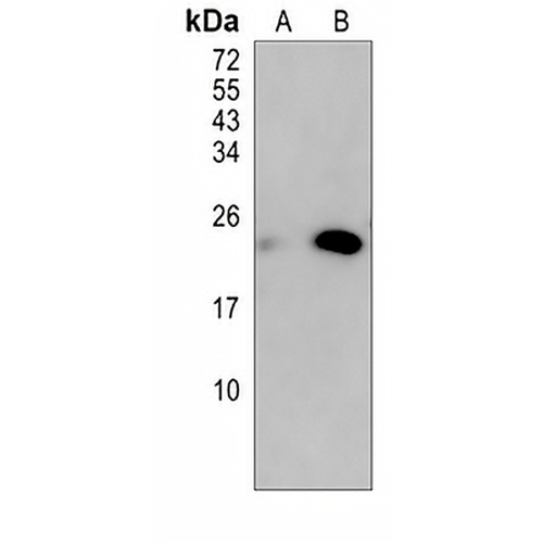 HBEGF Rabbit Monoclonal Antibody(C856)
