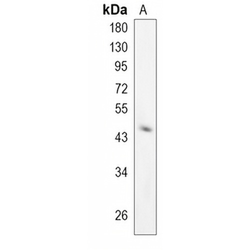 PREB Rabbit Monoclonal Antibody(C859)
