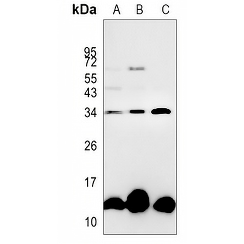 ICAT Rabbit Monoclonal Antibody(C862)