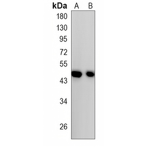 P4H-TM Rabbit Monoclonal Antibody(C863)