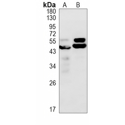 CaMK2 alpha Rabbit Monoclonal Antibody(C866)