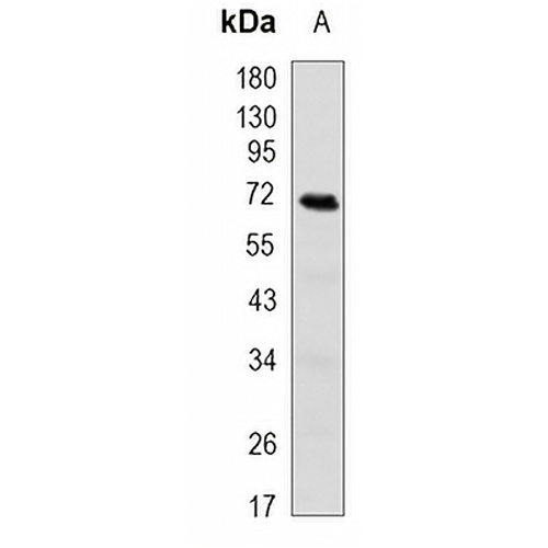 TGFBI Rabbit Monoclonal Antibody(C871)