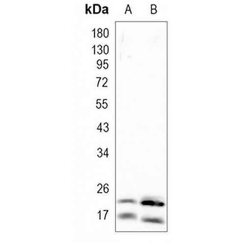 Caveolin 1 Rabbit Monoclonal Antibody(C872)