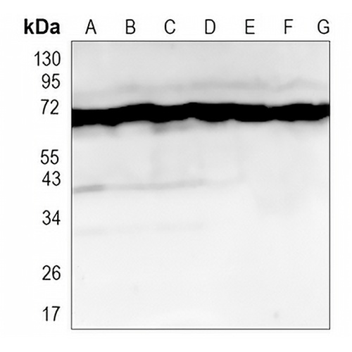 HSP70 Rabbit Monoclonal Antibody(C873)