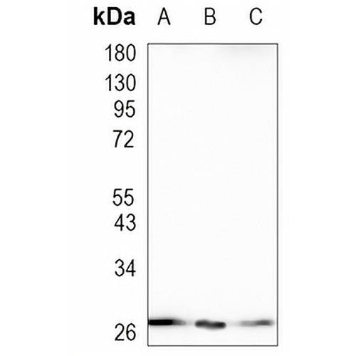 TFIIF RAP 30 Rabbit Monoclonal Antibody(C874)