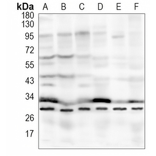 BDNF Rabbit Monoclonal Antibody(C875)