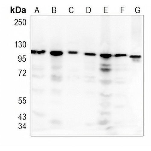 MVP Rabbit Monoclonal Antibody(C877)