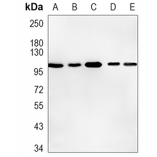 ACTL8 Rabbit Monoclonal Antibody(C878)