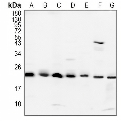 RAB9A Rabbit Monoclonal Antibody(C879)