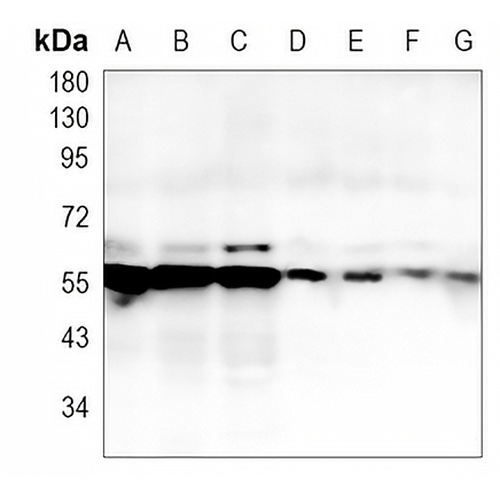 TXNRD1 Rabbit Monoclonal Antibody(C880)
