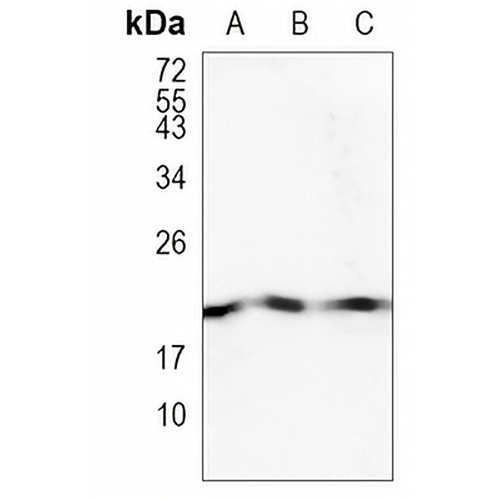 Cofilin Rabbit Monoclonal Antibody(C881)