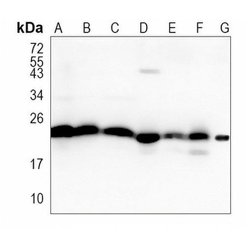 DHFR Rabbit Monoclonal Antibody(C882)
