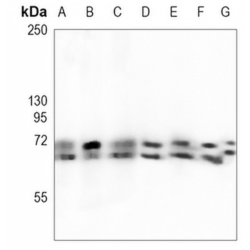 FMR1 Rabbit Monoclonal Antibody(C883)