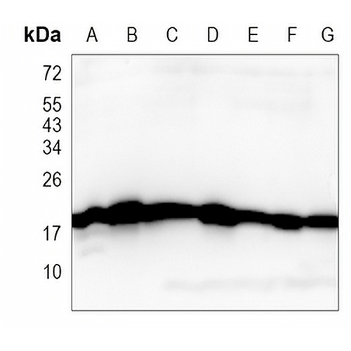 RKIP Rabbit Monoclonal Antibody(C884)