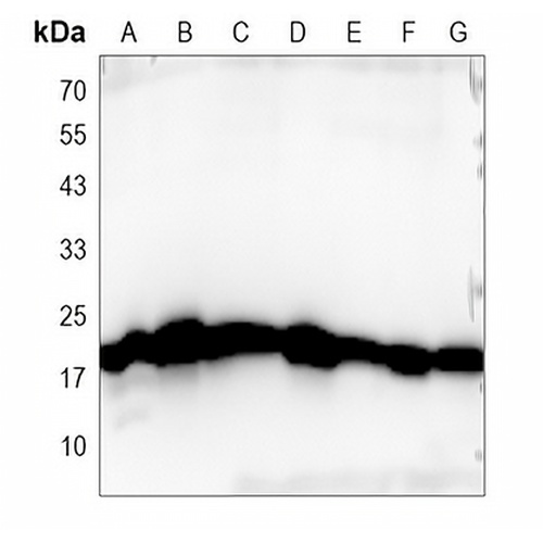 EMC4 Rabbit Monoclonal Antibody(C885)