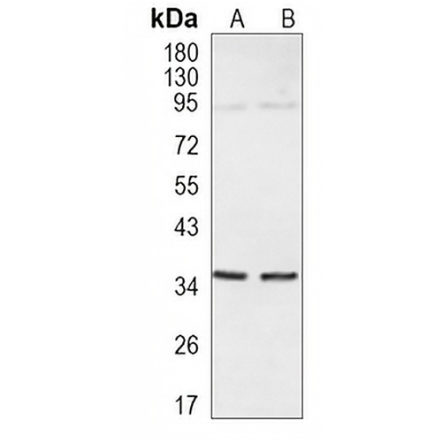 CD138 Rabbit Monoclonal Antibody(C886)