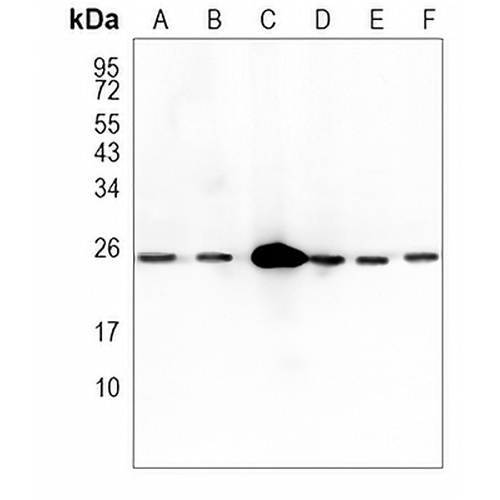 INMT Rabbit Monoclonal Antibody(C887)