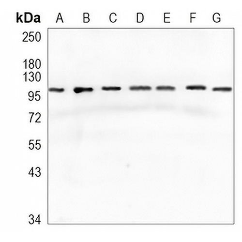 GART Rabbit Monoclonal Antibody(C888)