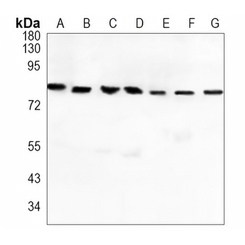 CD168 Rabbit Monoclonal Antibody(C891)