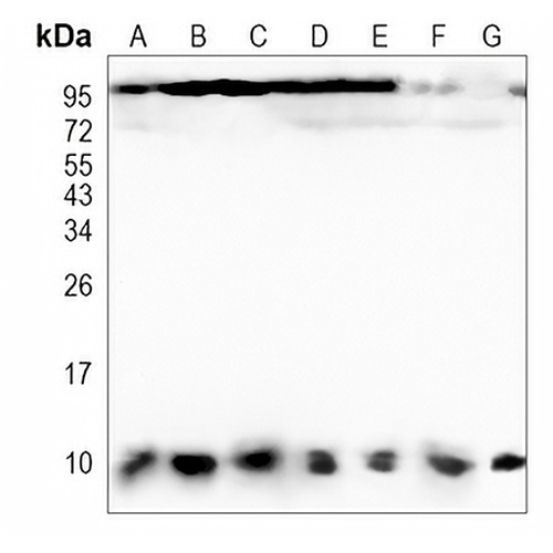 DYNLL1 Rabbit Monoclonal Antibody(C892)
