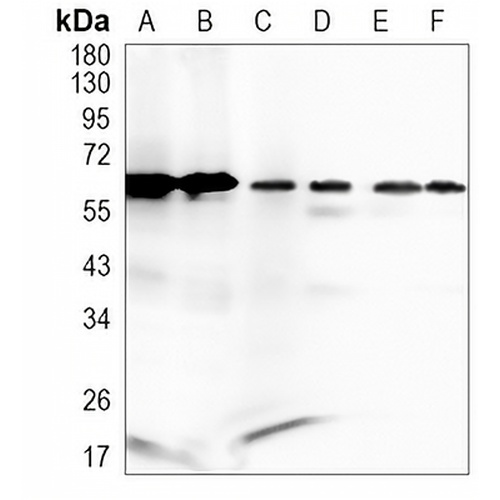 USP39 Rabbit Monoclonal Antibody(C893)