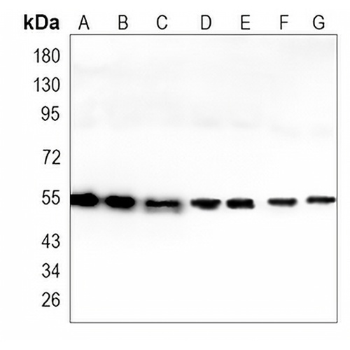 TFG Rabbit Monoclonal Antibody(C895)
