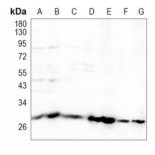 SDHB Rabbit Monoclonal Antibody(C896)
